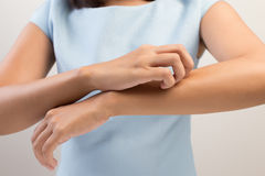 itching-woman-scratching-her-arm-53022949